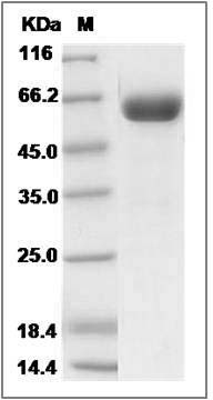 Rat EphA7 / EHK3 Protein (His Tag) SDS-PAGE