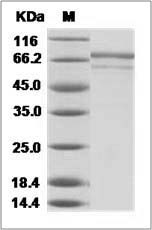 Influenza A H3N2 (A/X-31) Hemagglutinin / HA Protein (His Tag)