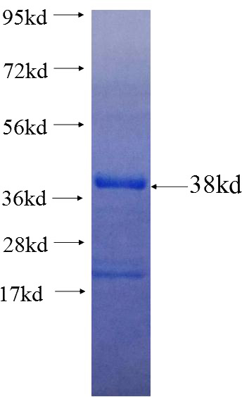 Recombinant Human CDC42EP3 SDS-PAGE