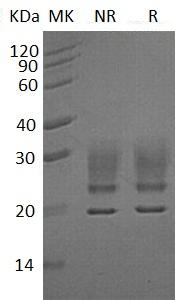 Human RNASE1/RIB1/RNS1 (His tag) recombinant protein