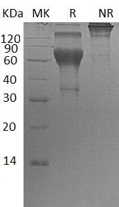 Human CD300C/CMRF35/CMRF35A (Fc tag) recombinant protein