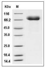 Influenza A H15N8 (A/duck/AUS/341/1983) Hemagglutinin / HA Protein (His Tag) SDS-PAGE