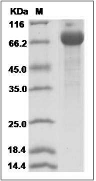 Rat SerpinE1 / PAI-1 Protein (Fc Tag) SDS-PAGE