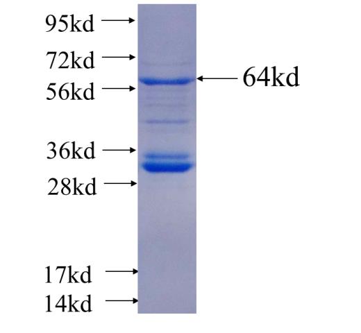 Recombinant human PPP2R1A SDS-PAGE