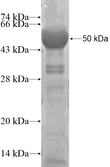 Recombinant Human C2orf62 SDS-PAGE