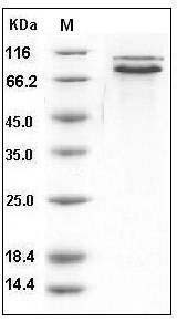 Human E-Cadherin / CDH1 / E-cad / CD324 Protein (His Tag) SDS-PAGE
