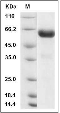 Rat CHODL / Chondrolectin Protein (Fc Tag) SDS-PAGE