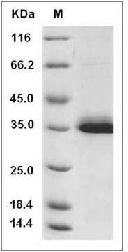Cynomolgus IGFBP1 Protein (His Tag) SDS-PAGE