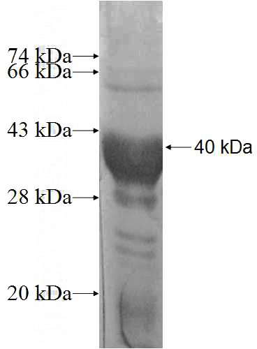 Recombinant Human ATPAF1 SDS-PAGE