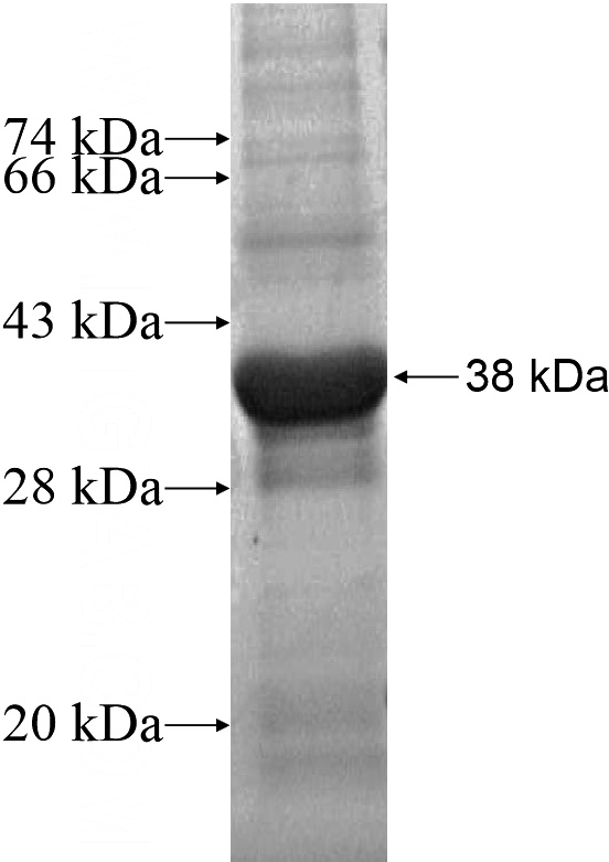 Recombinant Human UNC5C SDS-PAGE