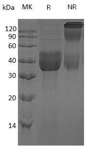 Human CLEC10A/CLECSF13/CLECSF14/HML (His tag) recombinant protein