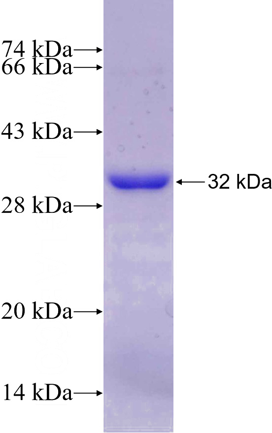 Recombinant Human COL10A1 SDS-PAGE