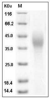 Human SLAMF7 / CRACC / CD319 Protein (His Tag) SDS-PAGE