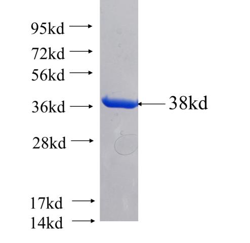 Recombinant human MYPT1 SDS-PAGE