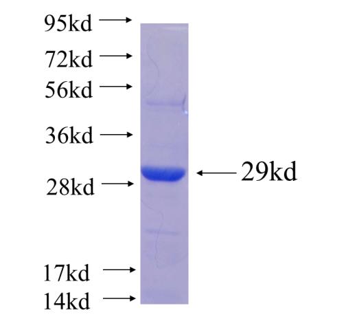 Recombinant human CNOT2 SDS-PAGE