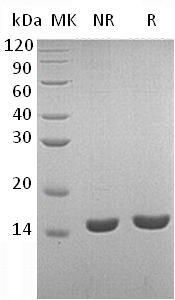 Human LYZ/LZM (His tag) recombinant protein