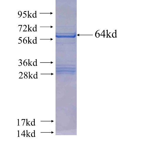 Recombinant human LGALS12(Full length) SDS-PAGE