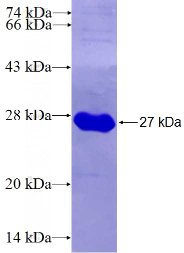 Recombinant Human DDX41 SDS-PAGE