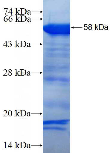 Recombinant Human IRF4 SDS-PAGE