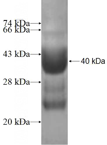 Recombinant Human C7orf49 SDS-PAGE