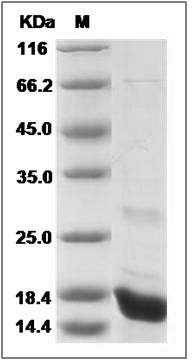 Human CEBPG / CEBP gamma Protein (His Tag) SDS-PAGE