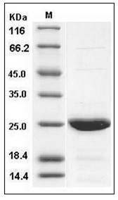 Human cIAP1 / HIAP2 Protein (AVI Tag) SDS-PAGE