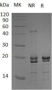 Human NCALD (His tag) recombinant protein