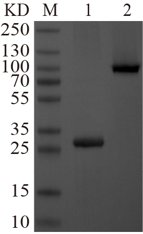 Recombinant SENP5 protein (His tag) Western Blot