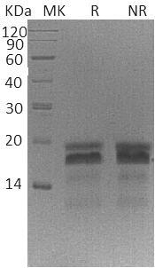 Human PTHLH/PTHRP (His tag) recombinant protein