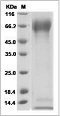 Influenza B (B/Massachusetts/03/2010) Hemagglutinin Protein (His Tag)