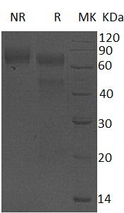 Human PROC (His tag) recombinant protein