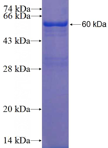 Human RNPS1 Recombinant protein (GST tag)