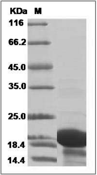 Human TPPP2 Protein (His Tag) SDS-PAGE