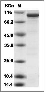 Human RIOK1 / RIO kinase 1 Protein (His & GST Tag) SDS-PAGE