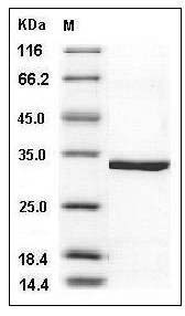 Human CA5A / CA-VA Protein (His Tag) SDS-PAGE