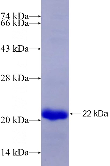 Recombinant Mouse Cdkn2a SDS-PAGE