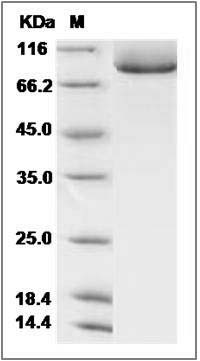 Human TGFBR3 / Betaglycan Protein (His Tag) SDS-PAGE