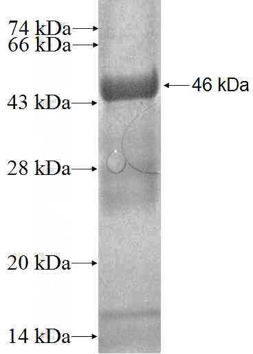 Recombinant Human FGFR1OP2 SDS-PAGE