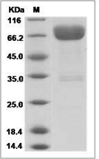 Rat CD80 / B7-1 Protein (Fc Tag)
