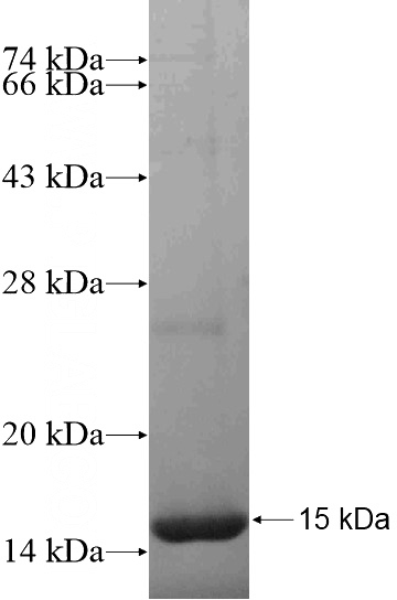 Recombinant Human LHFPL2 SDS-PAGE