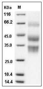 Mouse Clusterin / Apolipoprotein J / Apo-J / CLU Protein (His Tag) SDS-PAGE