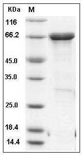 Human MTSS1 Protein (aa1-250, His & MBP Tag) SDS-PAGE