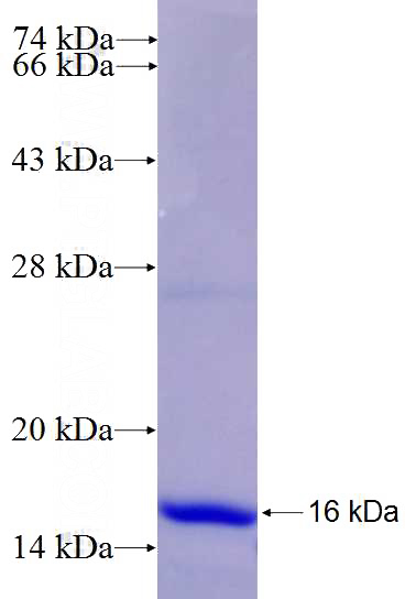 Recombinant Human ALOX15 SDS-PAGE