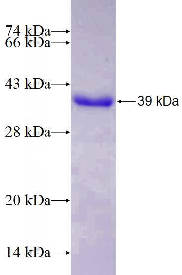 Recombinant Human IL-16 SDS-PAGE