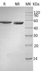 Human GC (His tag) recombinant protein