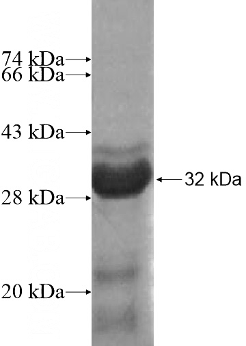 Recombinant Human ARMCX1 SDS-PAGE