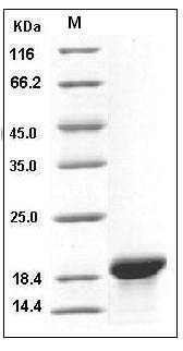 Human MOG Protein (aa 30-149, His Tag) SDS-PAGE