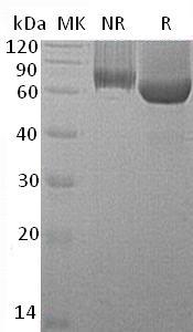 Mouse Gpc1 recombinant protein