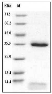 Human FCGRT & B2M Heterodimer Protein SDS-PAGE