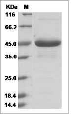 Mouse RARRES2 / TIG2 Protein (Fc Tag)